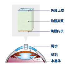 角膜障害